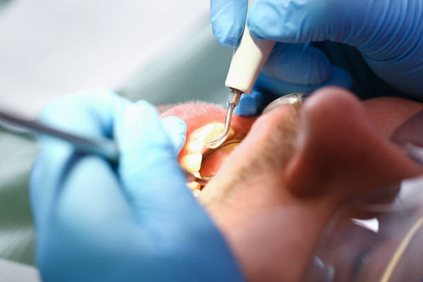 Best Emergency Denture Repair in Middleport, NY