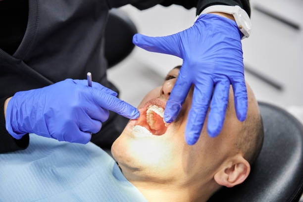 Best Emergency Dental Care for Broken or Chipped Teeth in Middleport, NY