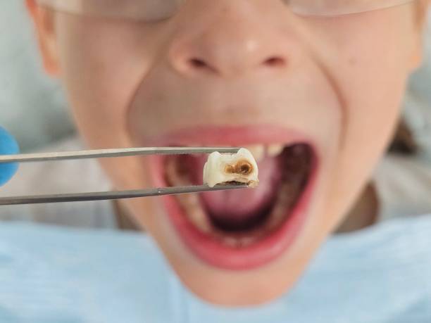 Best Same-Day Emergency Dental Services in Middleport, NY