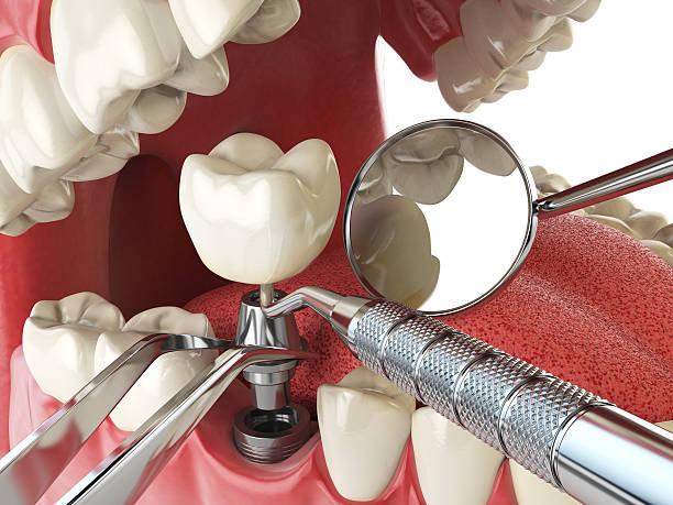 Best Emergency TMJ Treatment in Middleport, NY